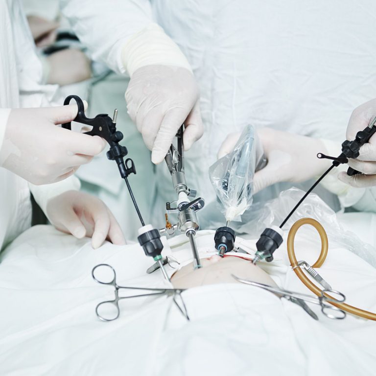 endoscopic-surgery-ob-gynae