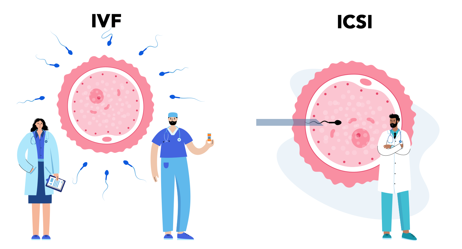 IVF-ICSI Fertility Treatment – OB GYNAE